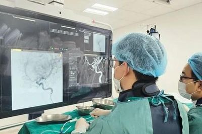 Đau đầu kéo dài cảnh giác với túi phình động mạch não nguy hiểm