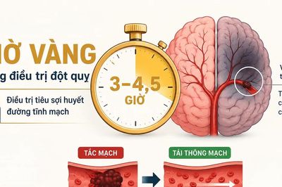 'Giờ vàng' đột quỵ: Ranh giới của hồi phục và tàn phế