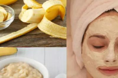 Đắp mặt nạ chuối đem lại lợi ích gì cho làn da?