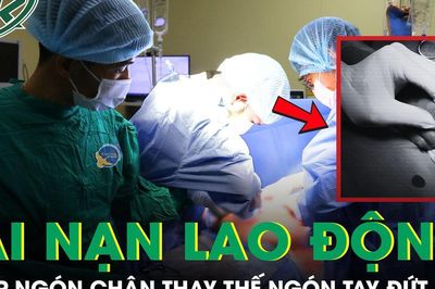 Nữ công nhân bị đứt lìa ngón tay do máy cắt giấy, phải ghép ngón chân thay thế