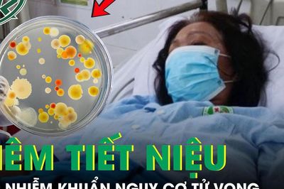 Người phụ nữ sốc nhiễm khuẩn, suy đa cơ quan, nguy cơ tử vong cao sau 3 ngày sốt, ho