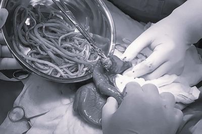 Nhóm người tuyệt đối không được quên tẩy giun