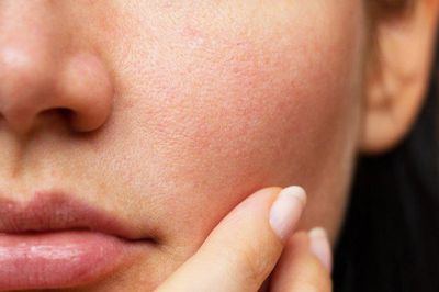 Da mịn hơn, lỗ chân lông bớt lộ rõ nhờ 4 bước chăm sóc nhiều người đang bỏ qua