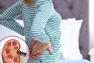 Sỏi thận âm thầm gây suy thận như thế nào?