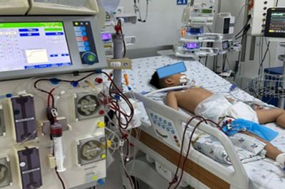 Bé trai 4 tuổi suy gan cấp, phải lọc máu liên tục vì được cho uống paracetamol hạ sốt 3 tiếng/lần