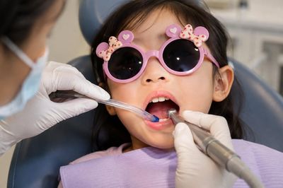 Đưa con chữa răng ở Mỹ hết hơn 100 triệu, về Việt Nam chưa đến 4 triệu đồng