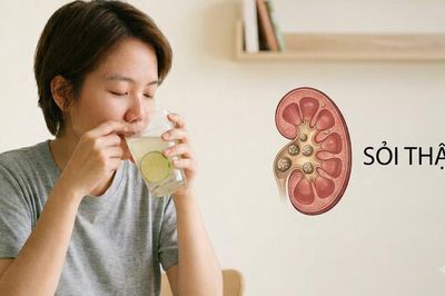 Người bị sỏi thận nên uống nước chanh hằng ngày như thế nào?