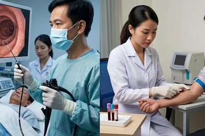 Xét nghiệm máu tầm soát ung thư đại trực tràng có thay được nội soi?