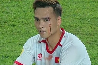 'Sát thủ' cao gần 2 m khiến trung vệ Việt Nam đổ máu
