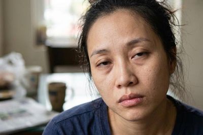 7 sai lầm trong chăm sóc da khiến da xỉn màu và mệt mỏi