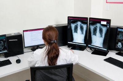Bộ Y tế đôn đốc khẩn trương phê duyệt giá dịch vụ chẩn đoán hình ảnh sử dụng PACS
