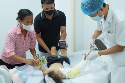 Bé gái 4 tuổi bị chấn thương nặng do áo chống nắng mắc bánh xe máy, bác sĩ đưa ra cảnh báo