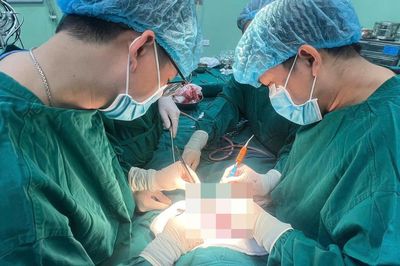 Bóc tách khối u quái nặng 1/3 trọng lượng cơ thể cho bé 4 tháng tuổi