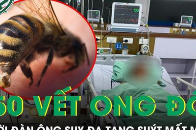 Đi bắt cá bị ong vò vẽ đốt 150 vết, người đàn ông suy đa tạng suýt mất mạng