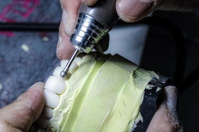 Những sai phạm khó tin trong sản xuất răng giả