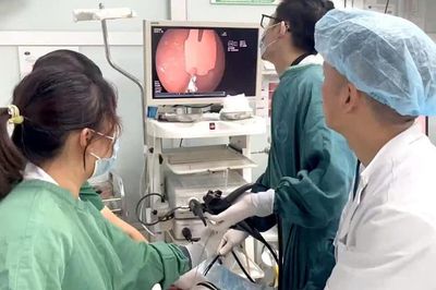 Nội soi cấp cứu bé 20 tháng nuốt phải mảnh thìa nhựa sắc nhọn