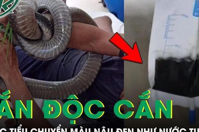 Đang quét sân, người đàn ông bị rắn độc cắn, nước tiểu bất ngờ chuyển màu nâu đen