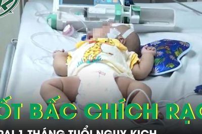 Tin mẹo dân gian, bé trai 1 tháng tuổi nguy kịch sau đốt bấc chích rạch chữa bệnh