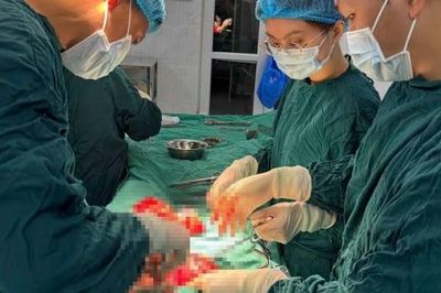Phẫu thuật thành công ca đa u xơ tử cung phức tạp, ổ bụng dính diện rộng
