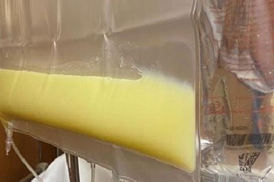 Người đàn ông 36 tuổi 'máu trắng đục như mỡ lợn' vì thường xuyên ăn món ai cũng thích