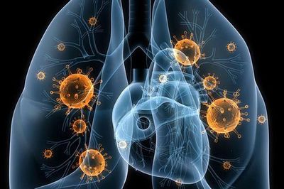 Viêm phổi do Adenovirus ở trẻ: Nhận biết sớm dấu hiệu nguy hiểm