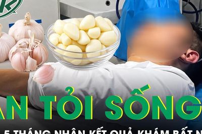 Ăn tỏi sống mỗi ngày suốt 5 tháng, người đàn ông 28 tuổi nhận kết quả khám khiến bác sĩ cũng bất ngờ