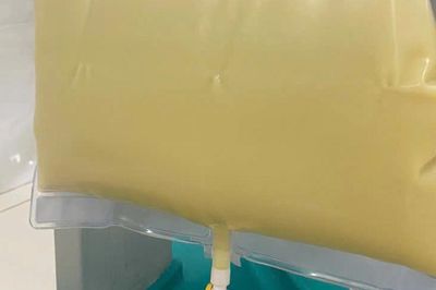 Nam thanh niên 'máu trắng đục như sữa' vì ăn thứ quen thuộc nhiều người mê