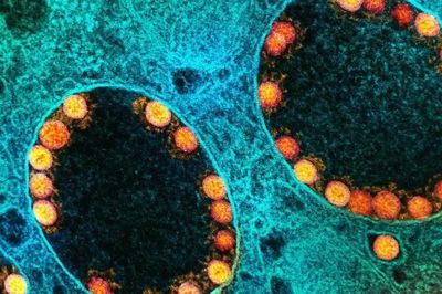 Mỹ lần đầu phê duyệt vaccine cúm mùa ứng dụng công nghệ mRNA