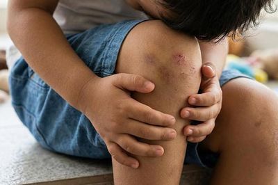 Té ngã, va đập ở học sinh, cách nào phòng tránh hiệu quả?