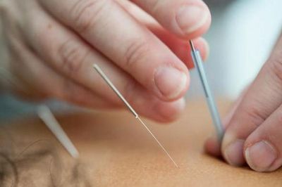Đau chân dữ dội sau khi châm cứu, người phụ nữ sốc nặng khi biết sự thật đáng sợ