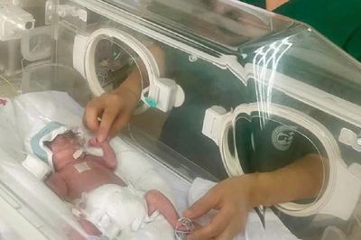 Kỳ tích cứu sống em bé sinh non 25 tuần, nặng chưa đầy 700 gram
