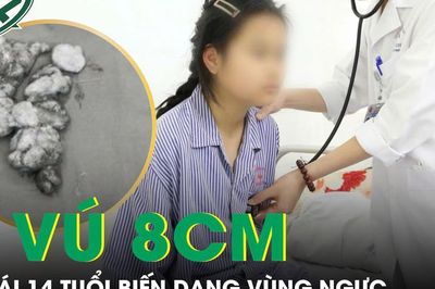 Bé gái 14 tuổi có khối u vú 8cm gây biến dạng
