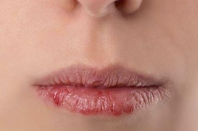 Muốn có một đôi môi hồng hào, căng mọng bạn hãy dừng lại ngay những thói quen này
