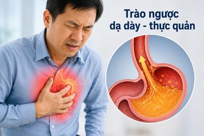 Đau ngực tưởng mắc bệnh tim, bác sĩ phát hiện 'thủ phạm' từ dạ dày