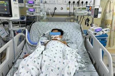 Ăn thịt chuột đồng một tuần, 3 trẻ rối loạn đông máu, một bé phải thở máy