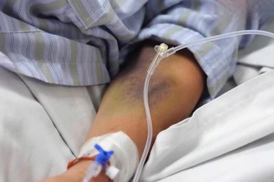 Hết sốt vẫn có thể chuyển bệnh nặng, bác sĩ chỉ dấu hiệu cảnh báo
