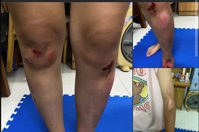 Công an xác minh thông tin vụ 2 cô gái bị đánh sau va chạm giao thông