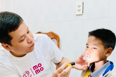 Gia Lai tổ chức chương trình phẫu thuật nụ cười miễn phí cho trẻ em trong tháng 8-2026