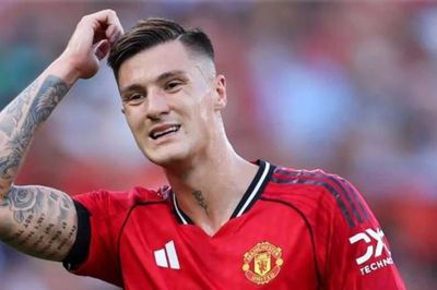 Benjamin Sesko tái phát chấn thương, lỡ cơ hội ra sân trận MU gặp Leeds tại Croke Park