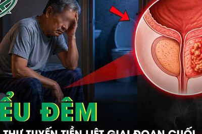 Người đàn ông 65 tuổi bất ngờ phát hiện ung thư tuyến tiền liệt giai đoạn cuối từ dấu hiệu tiểu đêm