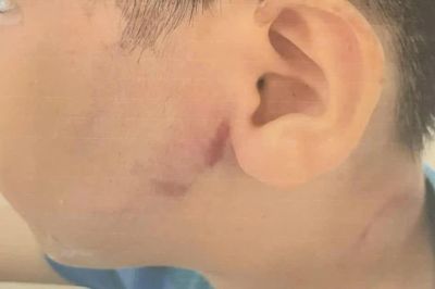 TPHCM: Nghi vấn bé trai 8 tuổi nhập viện do bị cha đánh
