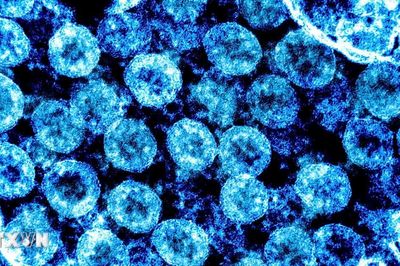 SARS-CoV-2 có thể kích hoạt virus tiềm ẩn, hé lộ cơ chế 'long COVID'