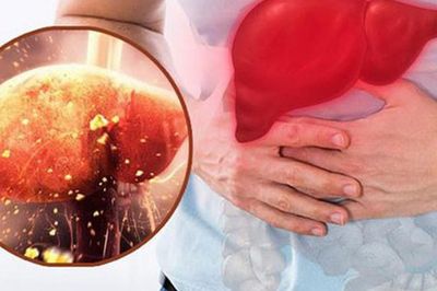 7 dấu hiệu tổn thương gan