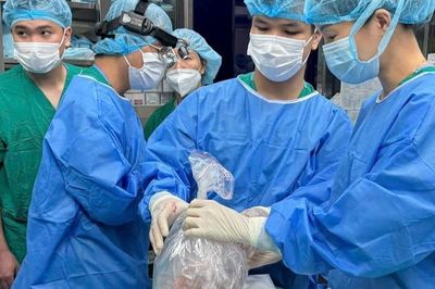 Chi phí ghép tạng mỗi nơi một giá, có ca lên tới 1,5 tỷ đồng
