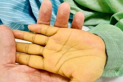 Tuổi 23 bàng hoàng với căn bệnh ác tính 'không còn làm gì được nữa'