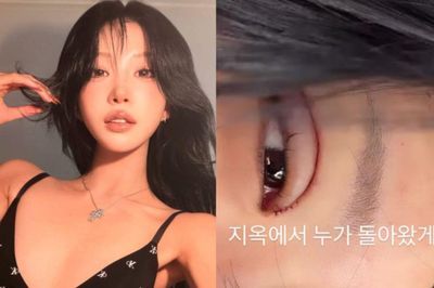 Sau 3 tháng kết hôn, Choi Joon Hee lộ đôi mắt sưng húp