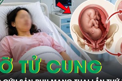 Cấp cứu kịp thời sản phụ mang thai lần thứ 7 vỡ tử cung