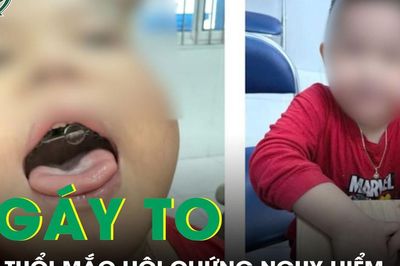 Ngáy to tưởng bình thường, bé trai 4 tuổi phát hiện mắc hội chứng nguy hiểm