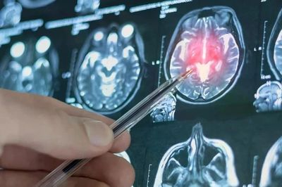 AI Trung Quốc có thể dự báo nguy cơ trầm cảm trước 4 năm chỉ từ cách nhìn khuôn mặt