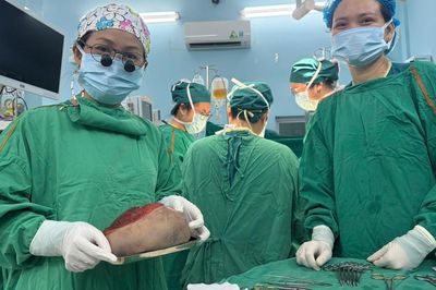Lấy trọn khối u quái nặng 1,3 kg cho bé gái 5 ngày tuổi